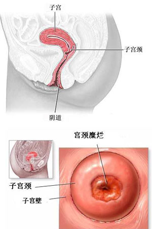 <b>子宫性不孕都有哪些症状呢</b>