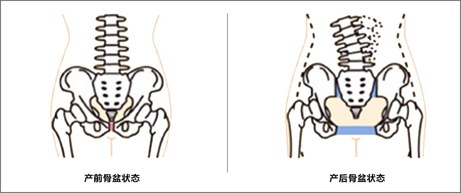 产前产后胯骨图图片